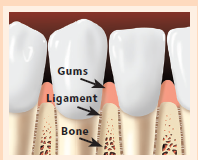 Teeth with gums, ligament, and bone pointed out