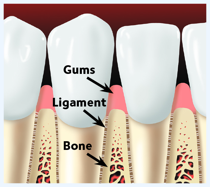 Diagram of mouth with gums, ligament, bone