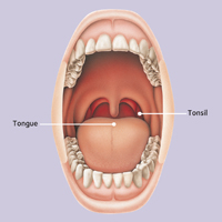 signs on throath cancer